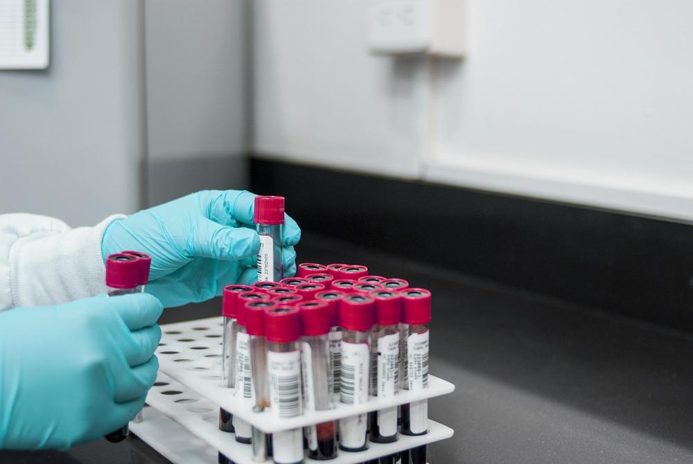 laboratory analysis